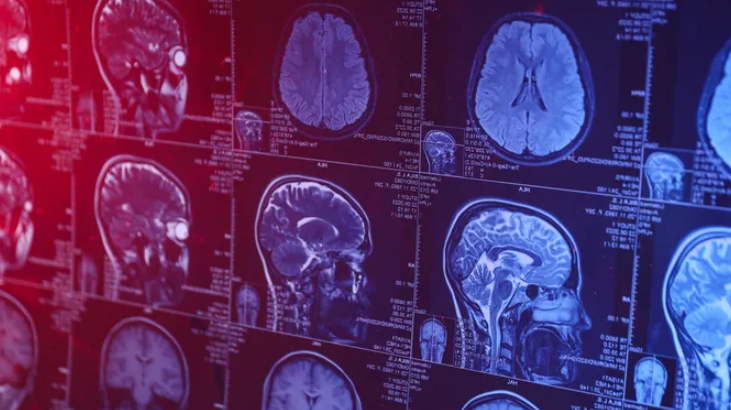 estimulación cognitiva